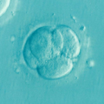 IVF (in vitro fertilization) technologies